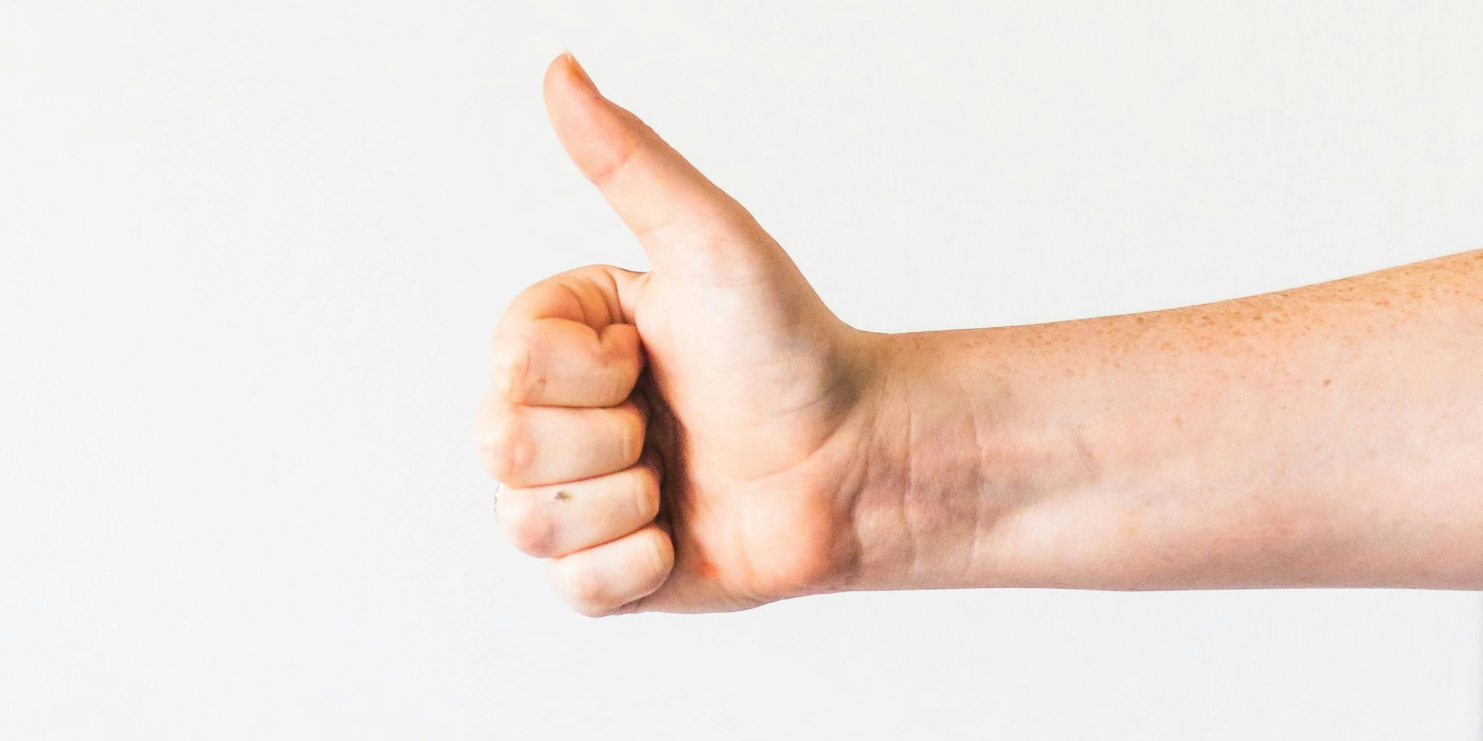 thumbs up by @sincerelymedia on Unsplash